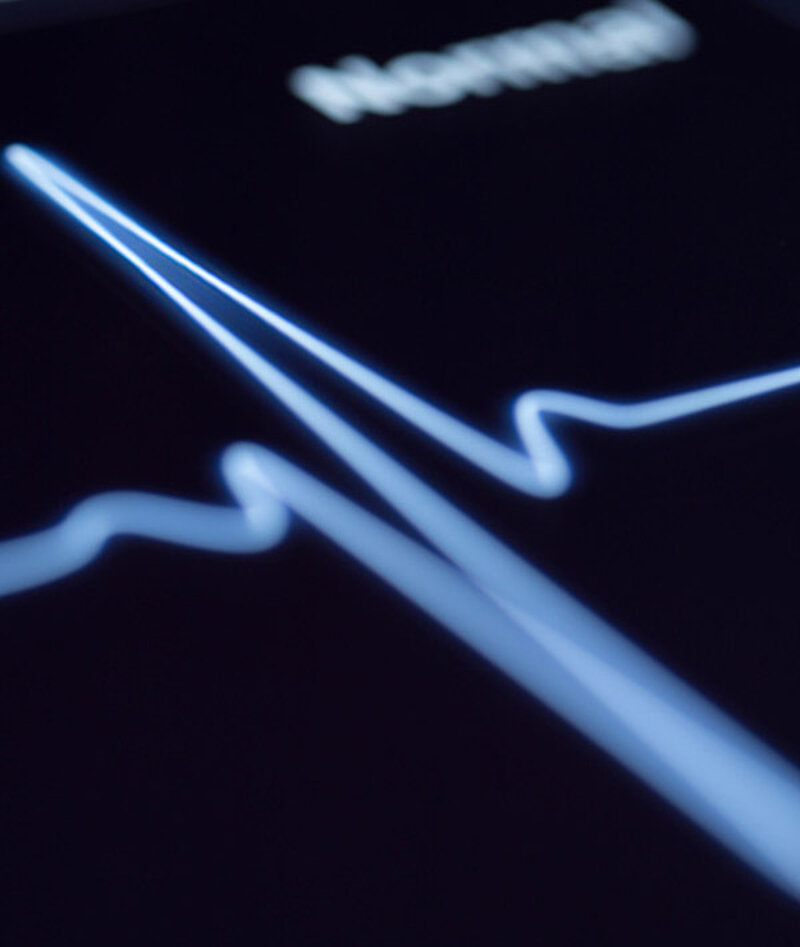 EKG auf dunklem Hintergrund